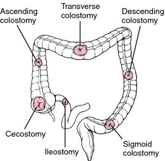Great illustration for future surgeons