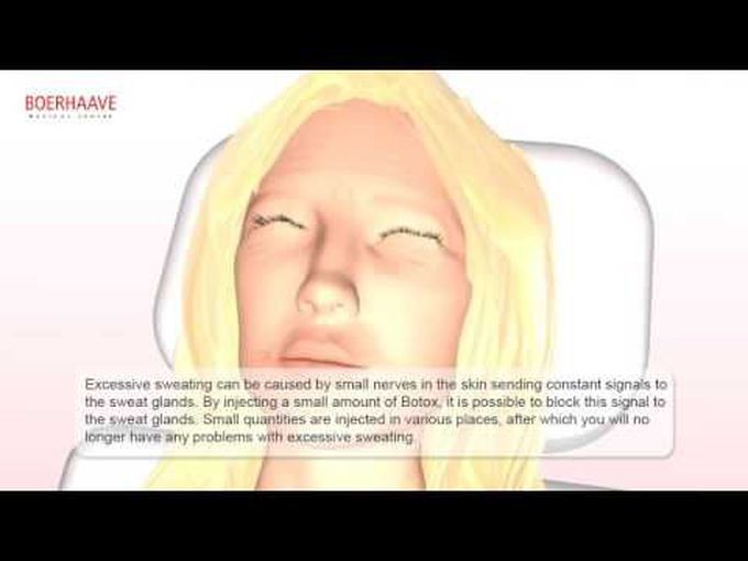 Botox and fillers-3D animation
