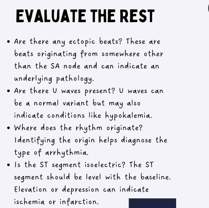 How to Read ECG- VIII