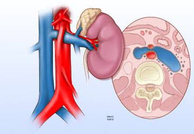 Causes of nutcracker syndrome