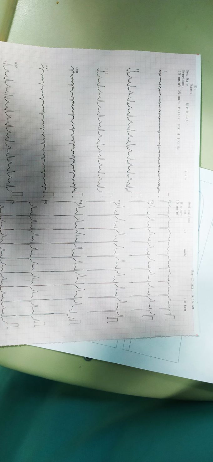 Acut kidney failure. Hyperkalemia