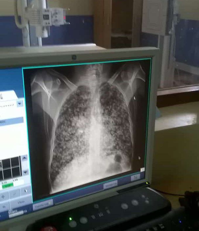 Radiograph