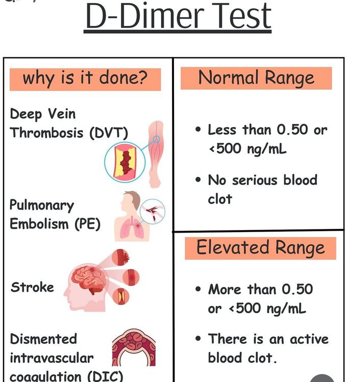 D-Dimer Test