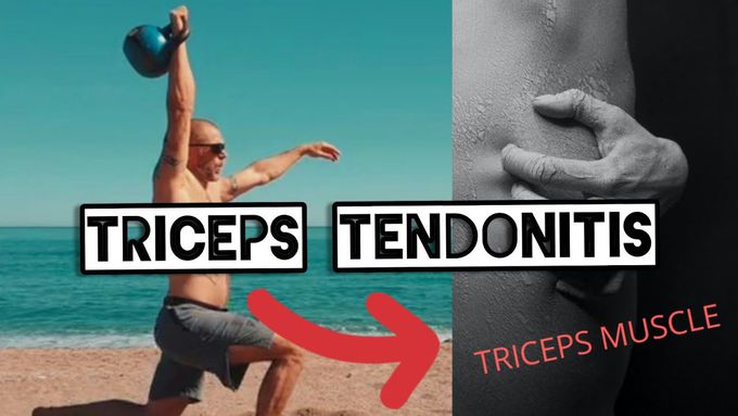 | HOW TO TREAT TRICEPS TENDONITI'S |