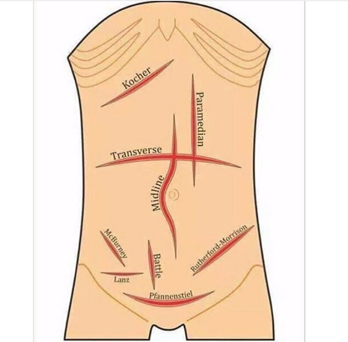 Projection points of the abdomen, as well as places where, through the abdomen, surgical interventions.