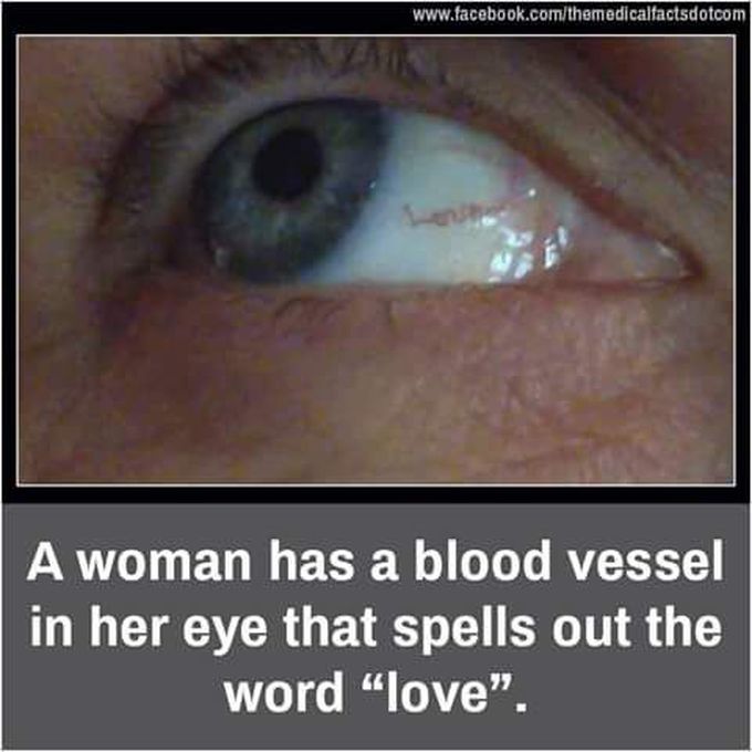 Amazing
