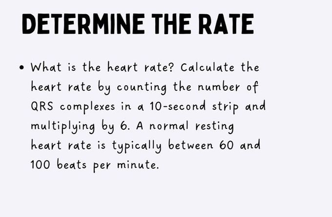 How to Read ECG- I