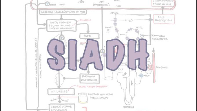 Syndrome of Inappropriate ADH secretion - SIADH (causes, pathophysiology, hyponaturemia, treatment)