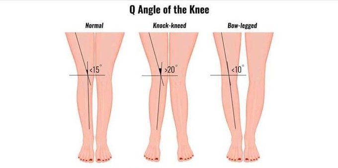 What is the Q-angle?