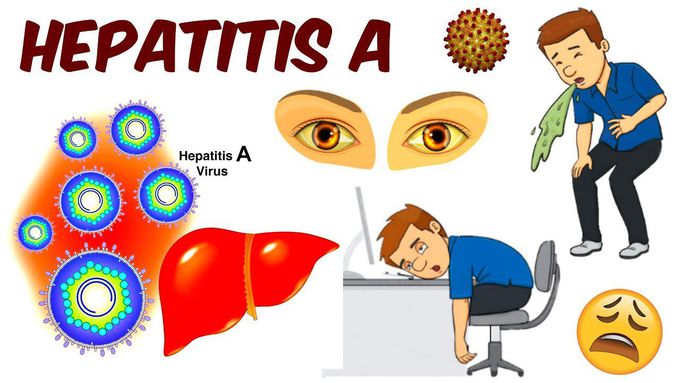 Hepatitis A