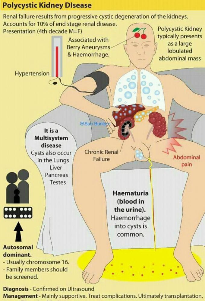 Polycystic kidney disease