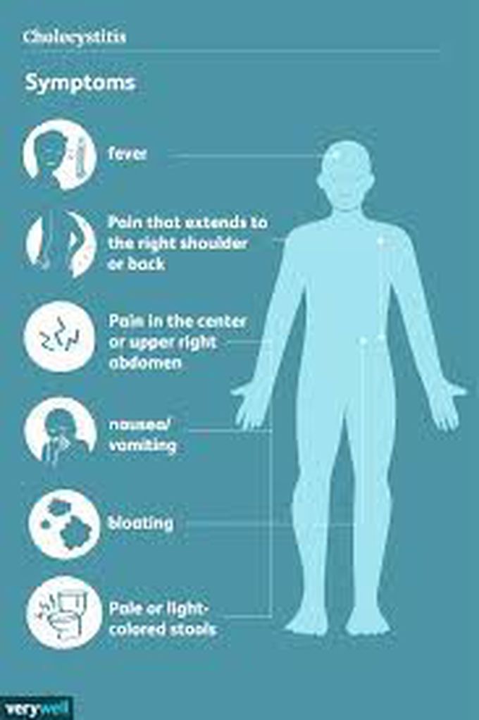 Symptoms of acute cholecystitis