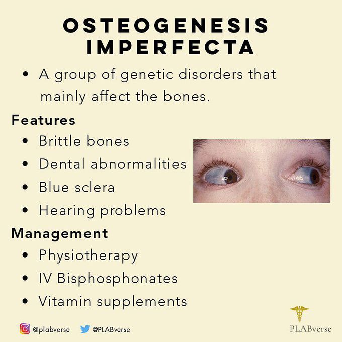 Osteogenesis Imperfecta (OI)