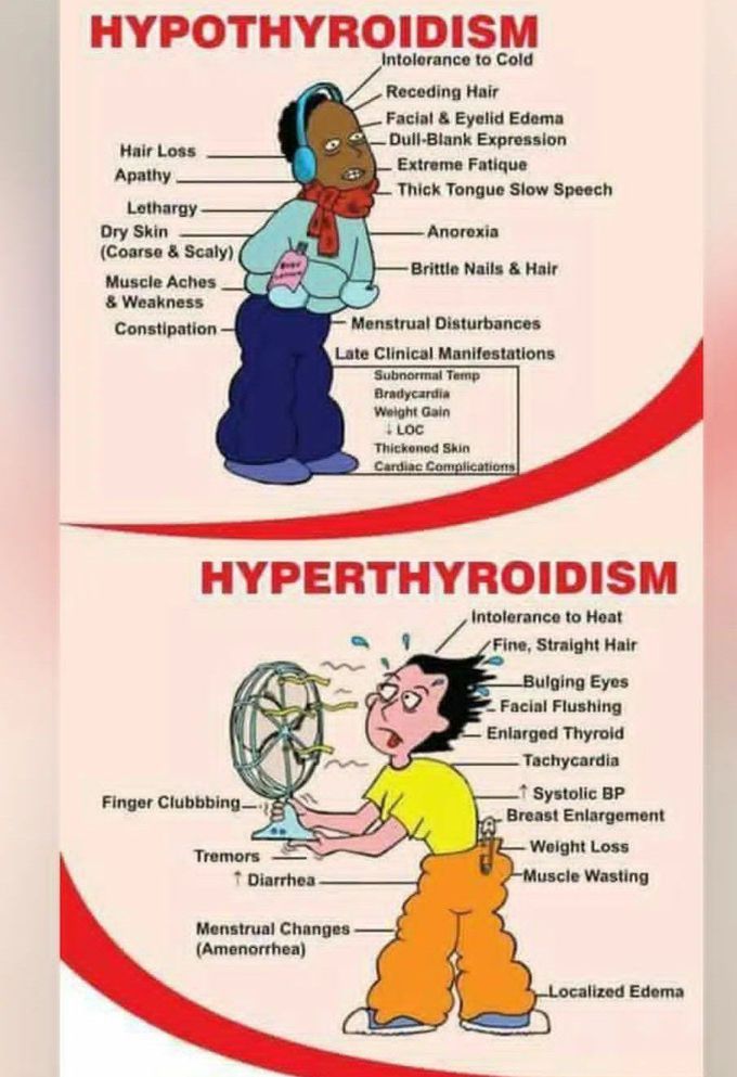 Hypothyroidism Vs Hyperthyroidism