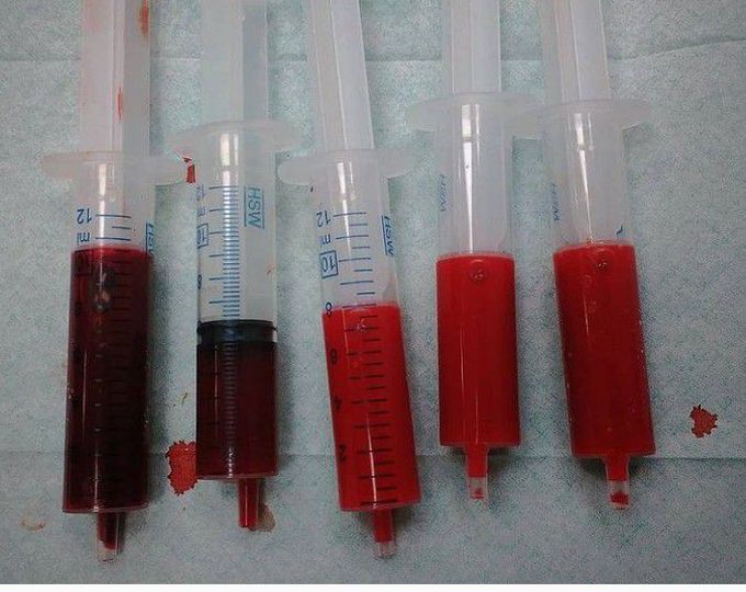 Difference between arterial and venous blood!!