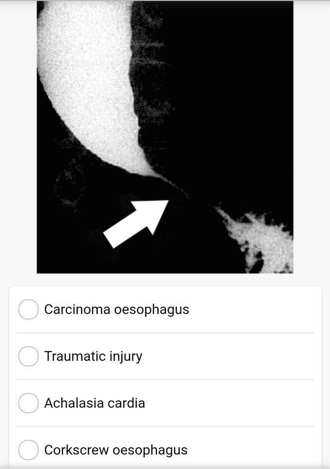 MCQ 01