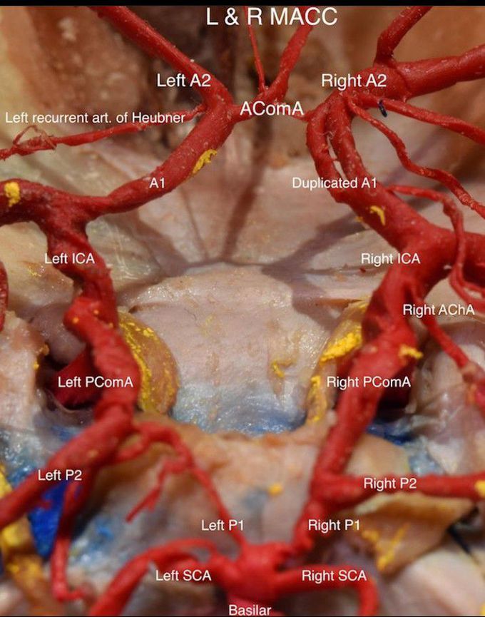 Circle of willis