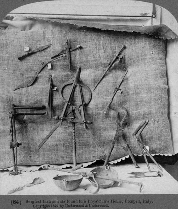 Ancient Roman surgical instruments