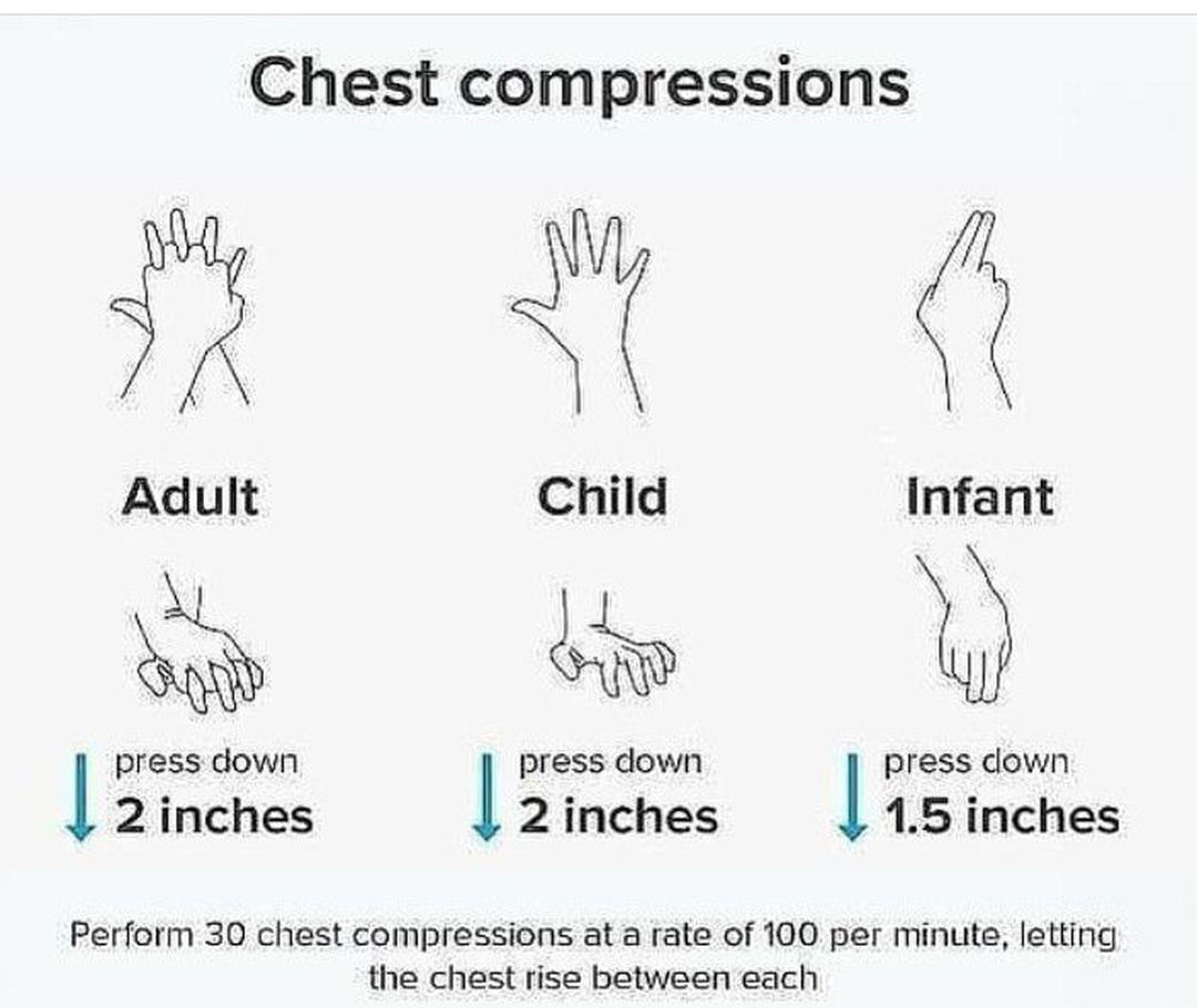 Chest Compressions Medizzy