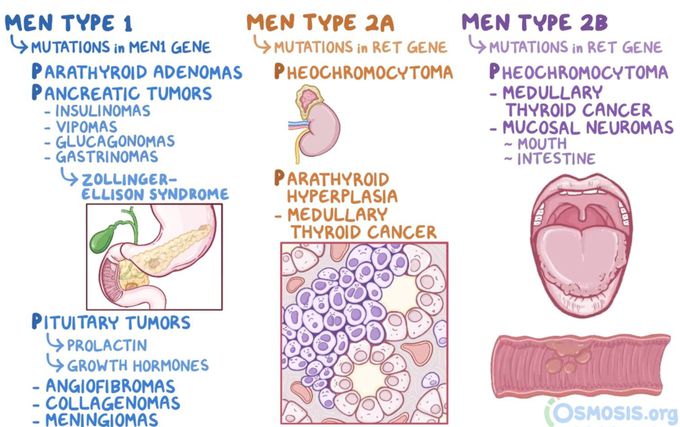 Multiple Endocrine Neoplasia