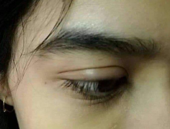 What should be diagnosis and treatment