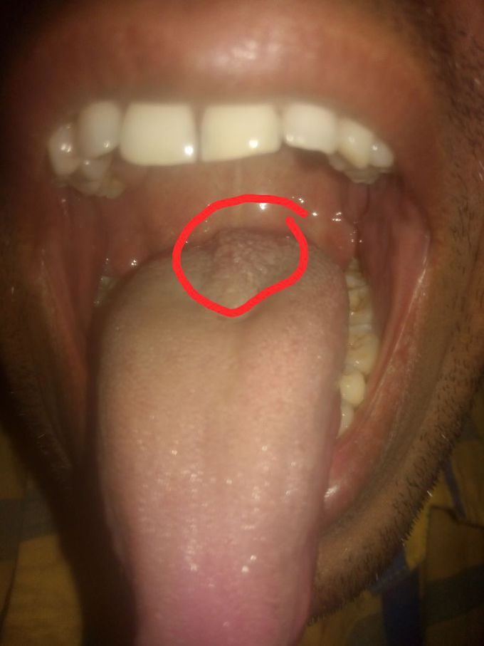 What is your diagnosis