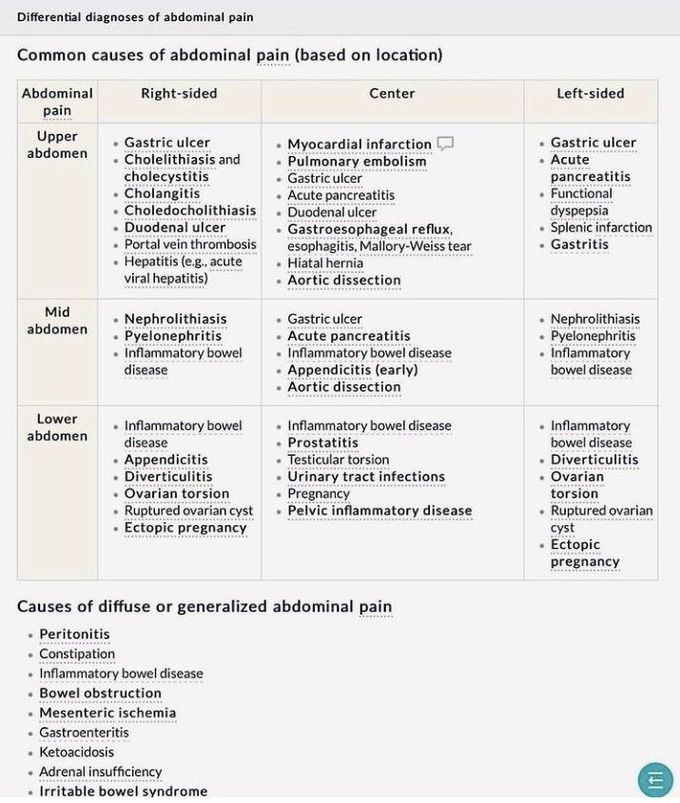 Abdominal pain- Differential Diagnosis