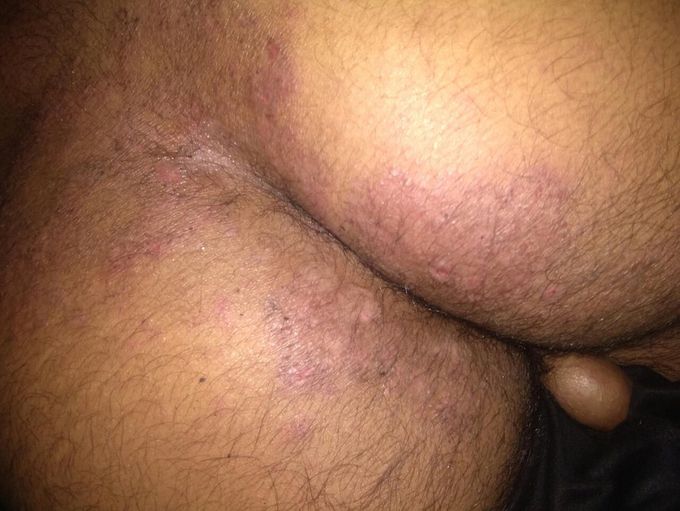 Diagnosis and treatment