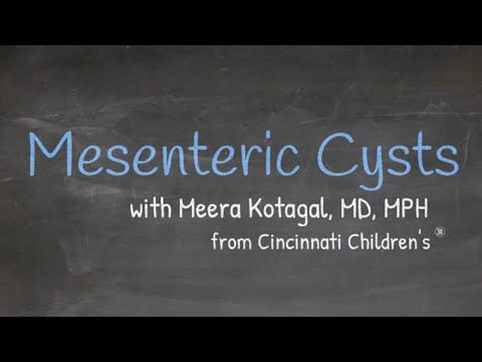 Mesenteric cysts: Overview