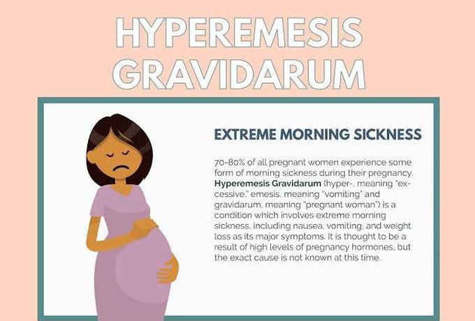 Hyperemesis Gravidarum