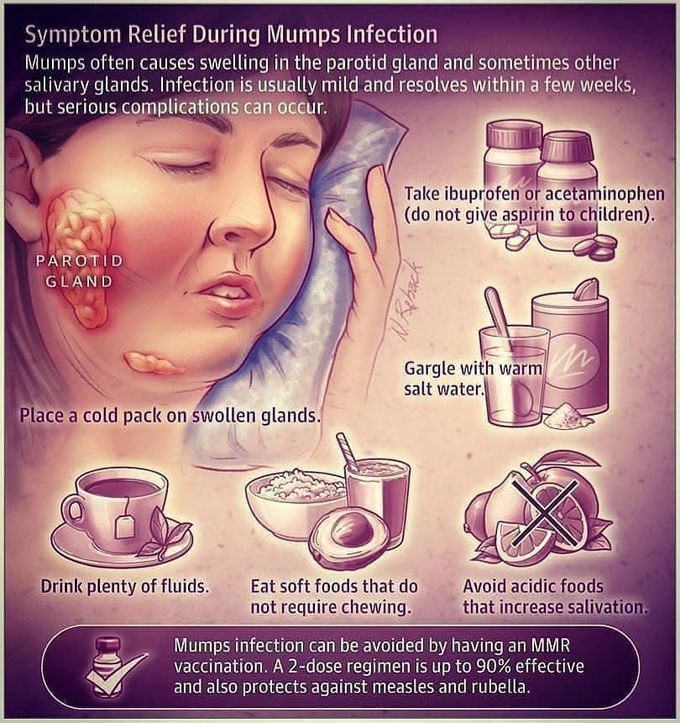 Symptomatic relief of mumps