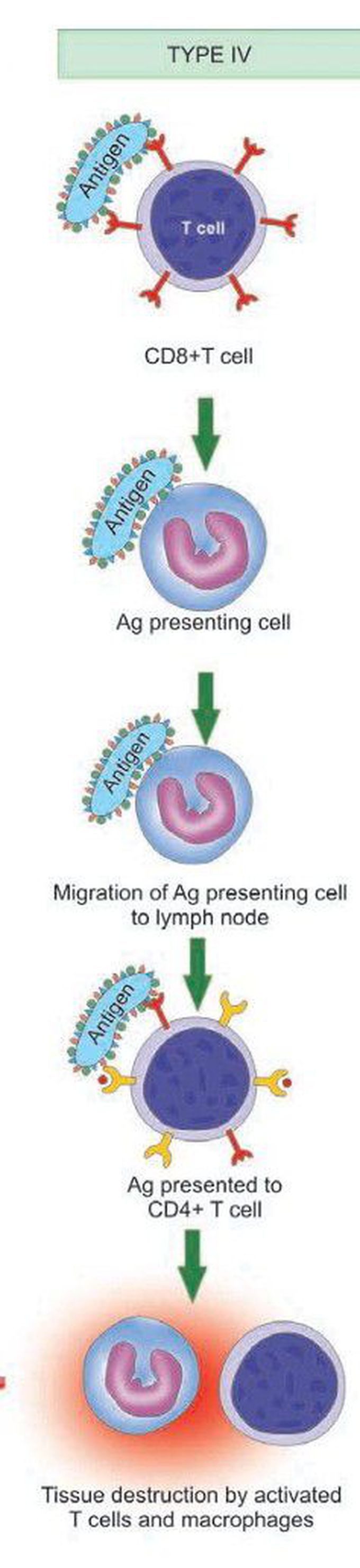 Type 4 hypersensitivity