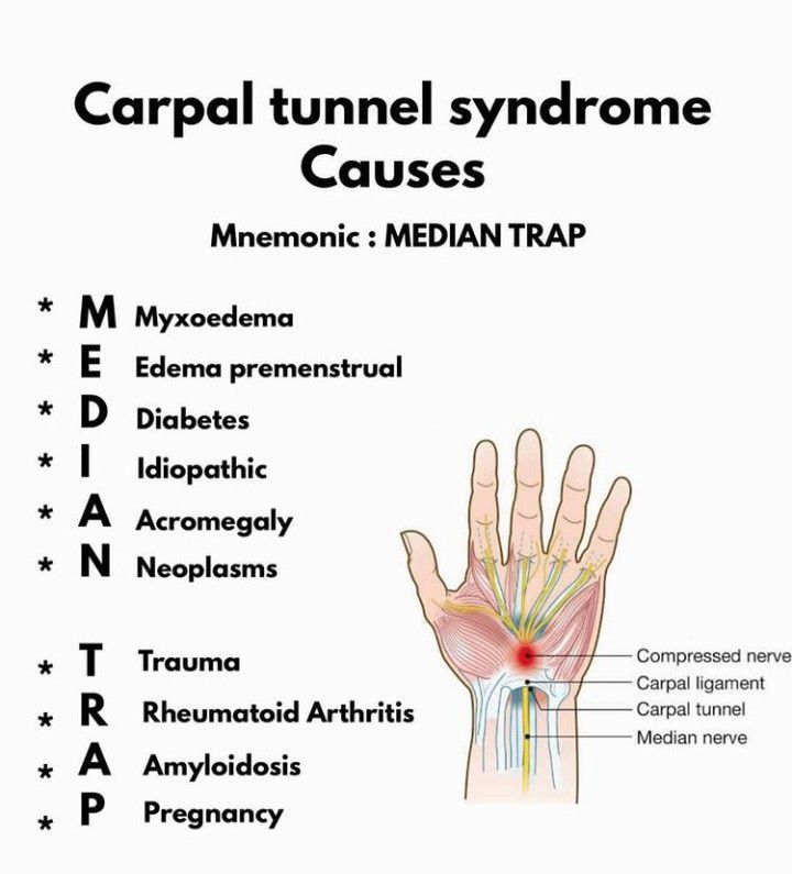 Learn causes of carpal tunnel syndrome