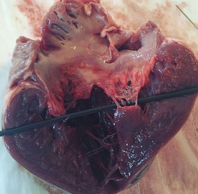 Cardio blog