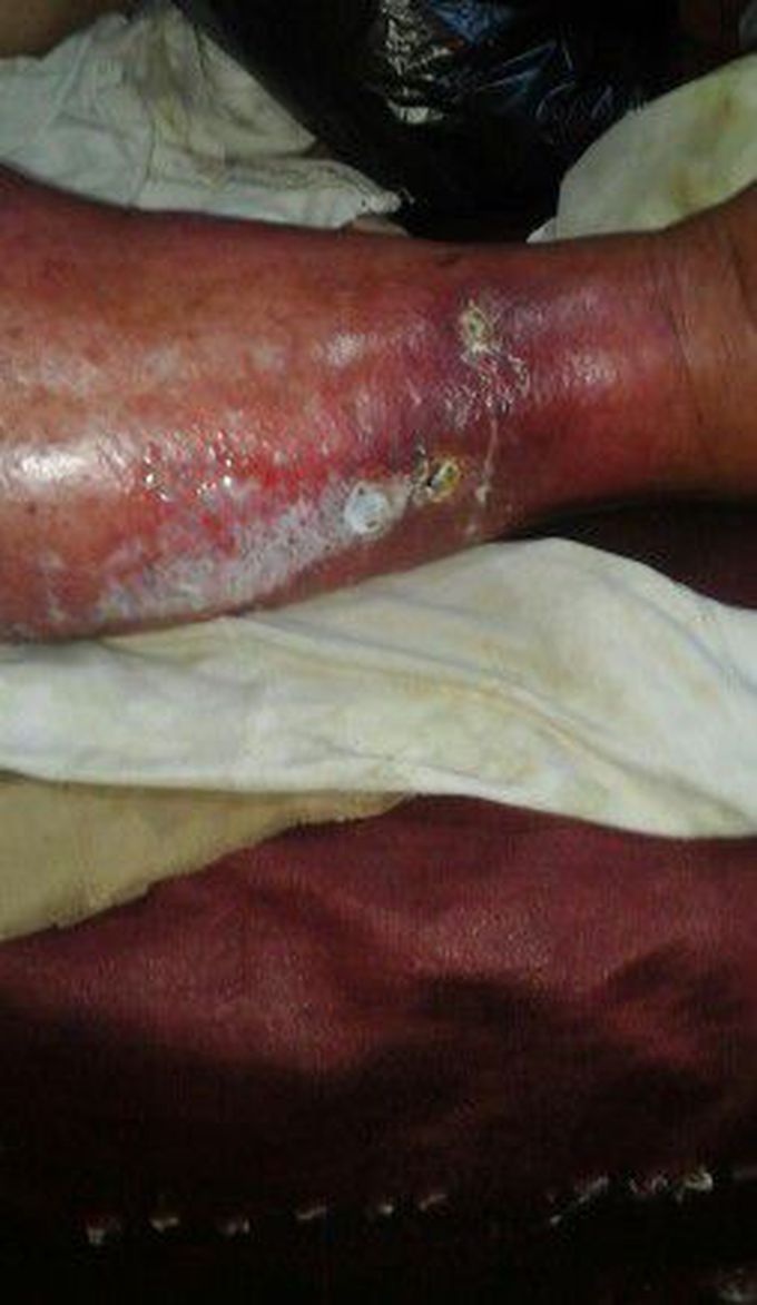Diagnosis plz?