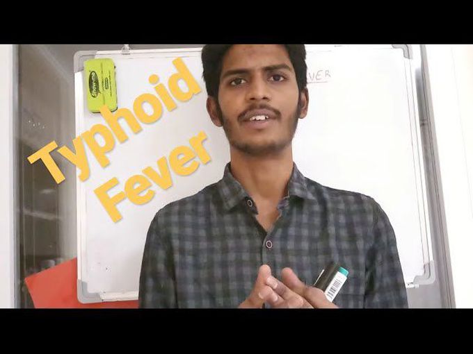 Typhoid fever