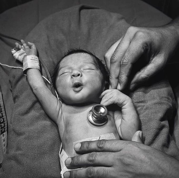 The Cutest baby reacting to a cold stethoscope!😍