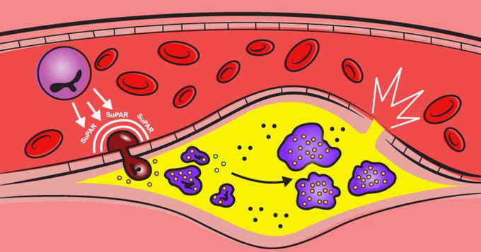 Immune protein discovery points to new heart disease treatment