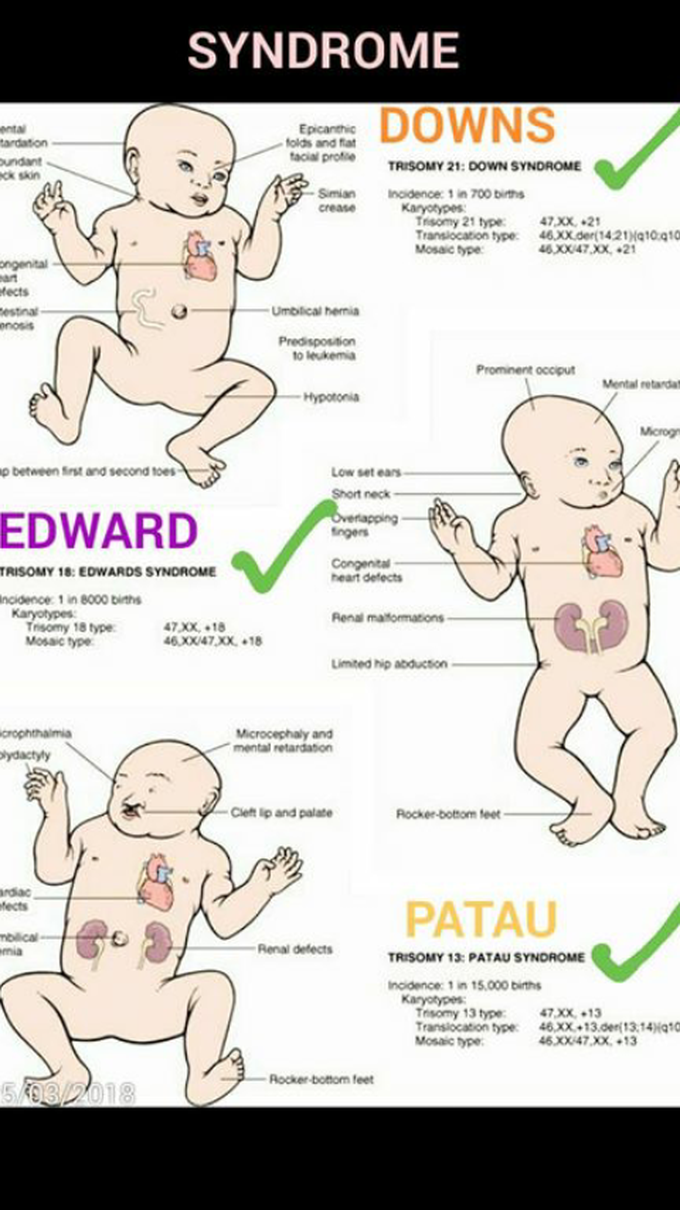 Most disease in children MEDizzy