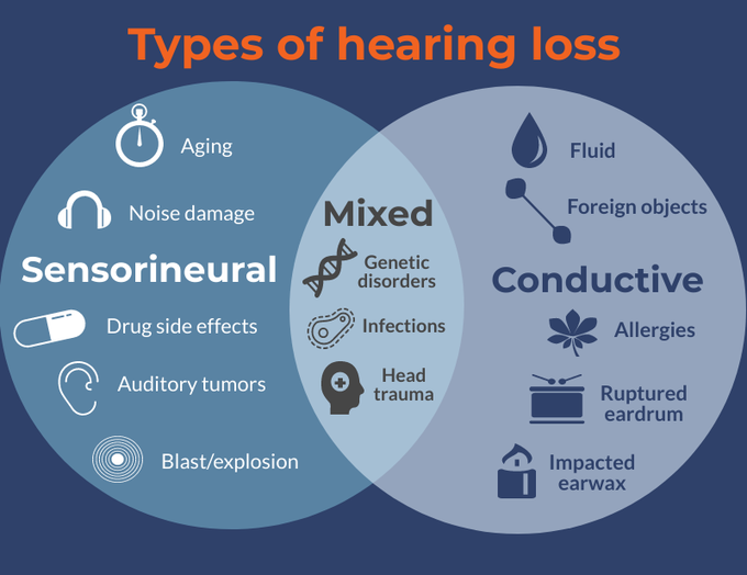 Sensorineural Hearing Loss