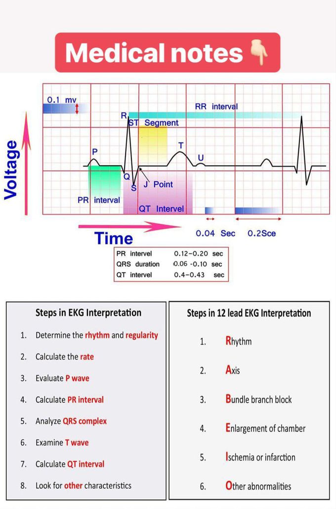 ECG