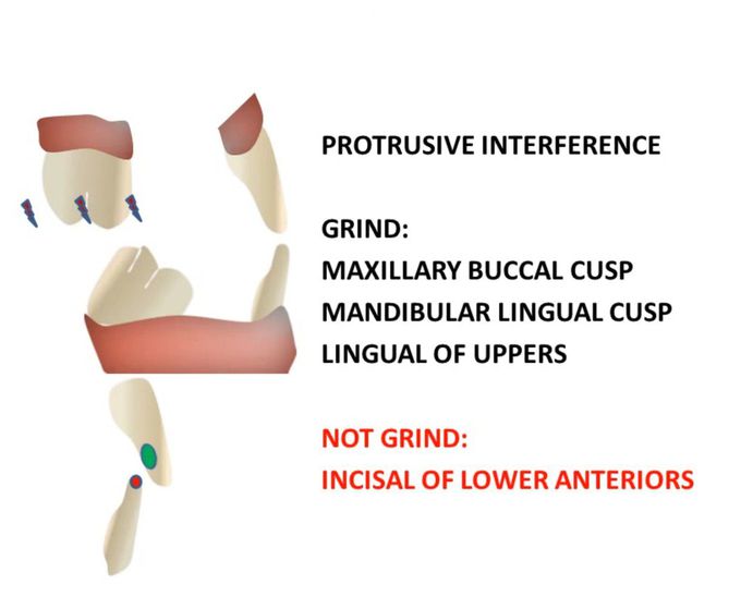 Protrusive Interference