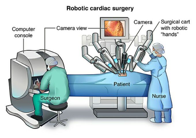 Robotic cardiac surgery