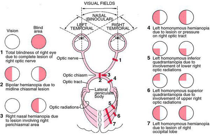 Visual fluid