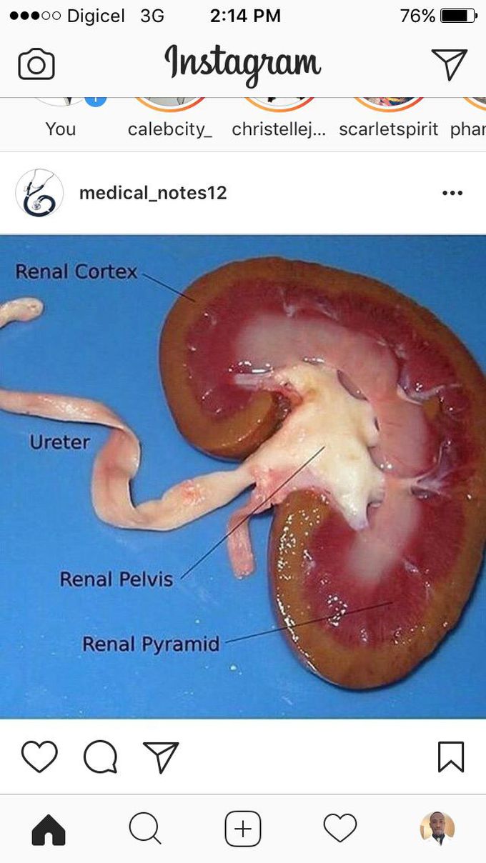 Kidney