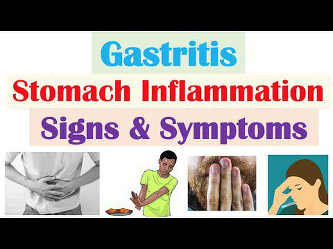 Gastritis: Presentation and Complications