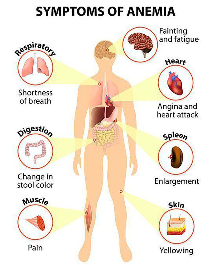 Major symptoms of anemia