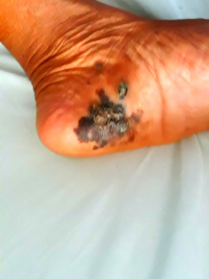 What is the diagnosis ? And Differentials