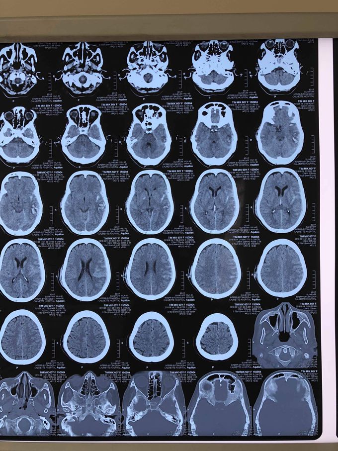 Diagnosis?
