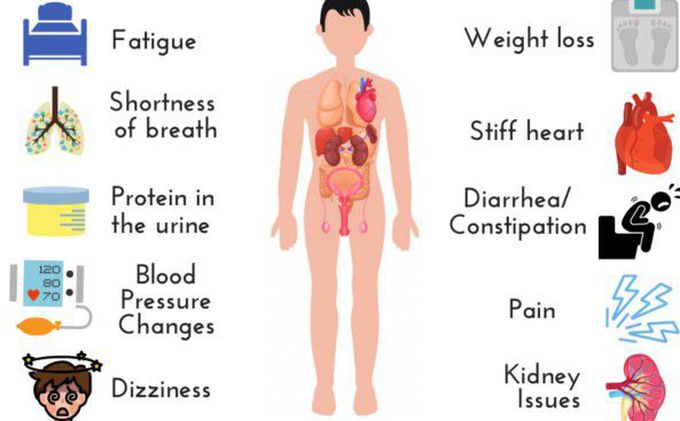 Causes of Amyloidosis
